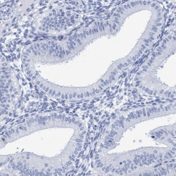 Invitrogen PERP Polyclonal Antibody 100 &mu;L; Unconjugated:Antibodies,