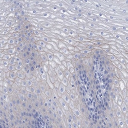Invitrogen PERP Polyclonal Antibody 100 &mu;L; Unconjugated:Antibodies,