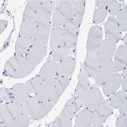 Invitrogen PERP Polyclonal Antibody 100 &mu;L; Unconjugated:Antibodies,