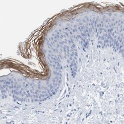 Invitrogen PERP Polyclonal Antibody 100 &mu;L; Unconjugated:Antibodies,