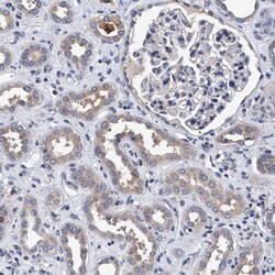 Invitrogen CALCOCO2 Polyclonal Antibody 100 &mu;L; Unconjugated:Antibodies,