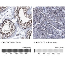 Invitrogen CALCOCO2 Polyclonal Antibody 100 &mu;L | Buy Online | Invitrogen&trade; | Fisher Scientific