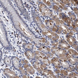 Invitrogen CALCOCO2 Polyclonal Antibody 100 &mu;L; Unconjugated:Antibodies,