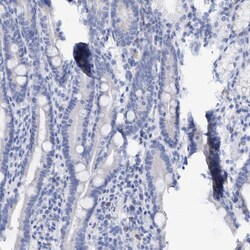Invitrogen Cytokeratin 14 Polyclonal Antibody 100 &mu;L | Buy Online | Invitrogen&trade; | Fisher Scientific
