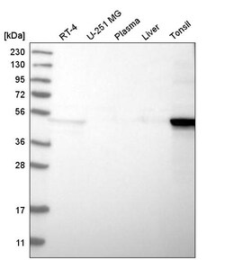 Invitrogen Cytokeratin 14 Polyclonal Antibody 100 &mu;L | Buy Online | Invitrogen&trade; | Fisher Scientific