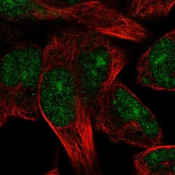 Invitrogen TRIM72 Polyclonal Antibody 100 μL; Unconjugated:Antibodies,