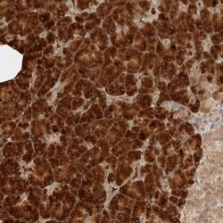 Invitrogen ZBTB2 Polyclonal Antibody 100 μL; Unconjugated:Antibodies,