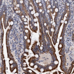 Invitrogen DECR1 Polyclonal Antibody 100 &mu;L | Buy Online | Invitrogen&trade; | Fisher Scientific