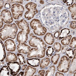 Invitrogen DECR1 Polyclonal Antibody 100 &mu;L | Buy Online | Invitrogen&trade; | Fisher Scientific