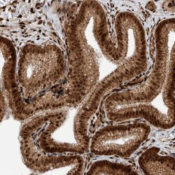 Invitrogen ZNF366 Polyclonal Antibody 100 &mu;L; Unconjugated:Antibodies,