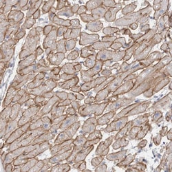Invitrogen Dystrophin Polyclonal Antibody 100 &mu;L; Unconjugated:Antibodies,