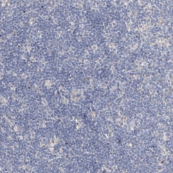 Invitrogen™ Protein S Polyclonal Antibody