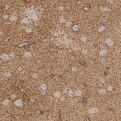 PIST Polyclonal Antibody:Antibodies, Polyclonal