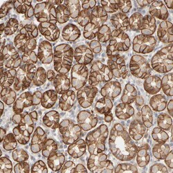 PIST Polyclonal Antibody:Antibodies, Polyclonal