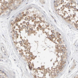 PIST Polyclonal Antibody:Antibodies, Polyclonal