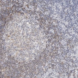 Invitrogen CD22 Polyclonal Antibody 100 &mu;L; Unconjugated:Antibodies,
