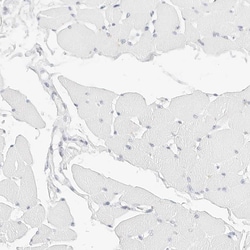 Invitrogen CD22 Polyclonal Antibody 100 &mu;L; Unconjugated:Antibodies,