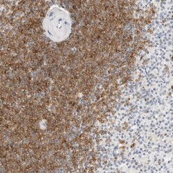 Invitrogen CD22 Polyclonal Antibody 100 &mu;L; Unconjugated:Antibodies,