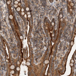 Invitrogen SCARA5 Polyclonal Antibody 100 &mu;L | Buy Online | Invitrogen&trade; | Fisher Scientific