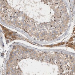 Invitrogen SCARA5 Polyclonal Antibody 100 &mu;L | Buy Online | Invitrogen&trade; | Fisher Scientific