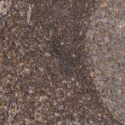 Invitrogen SCARA5 Polyclonal Antibody 100 &mu;L | Buy Online | Invitrogen&trade; | Fisher Scientific