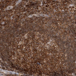 Invitrogen GFR alpha-2 Polyclonal Antibody 100 &mu;L; Unconjugated:Antibodies,