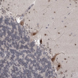 Invitrogen MTBP Polyclonal Antibody 100 μL; Unconjugated:Antibodies,