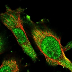 ACAT2 Polyclonal Antibody:Antibodies, Polyclonal