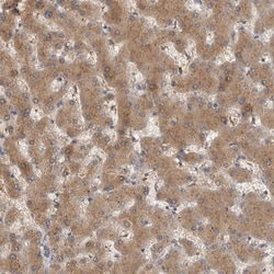 ACAT2 Polyclonal Antibody:Antibodies, Polyclonal