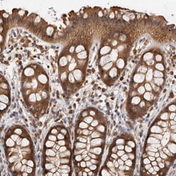 ACAT2 Polyclonal Antibody:Antibodies, Polyclonal