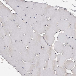 ACAT2 Polyclonal Antibody:Antibodies, Polyclonal
