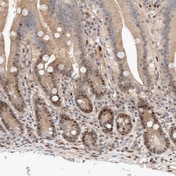Invitrogen TCF4 Polyclonal Antibody 100 &mu;L; Unconjugated:Antibodies,