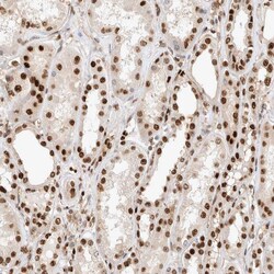 Invitrogen TCF4 Polyclonal Antibody 100 &mu;L; Unconjugated:Antibodies,