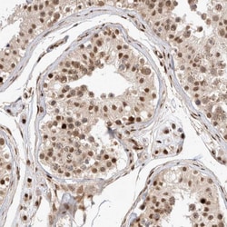 Invitrogen TCF4 Polyclonal Antibody 100 &mu;L; Unconjugated:Antibodies,