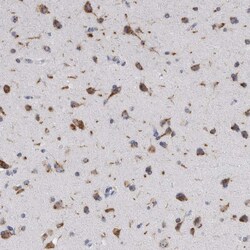 Invitrogen AKAP9 Polyclonal Antibody 100 &mu;L; Unconjugated:Antibodies,