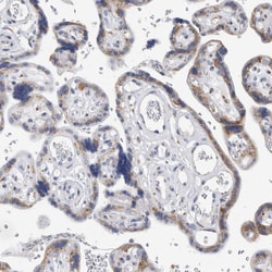 Invitrogen AKAP9 Polyclonal Antibody 100 &mu;L; Unconjugated:Antibodies,