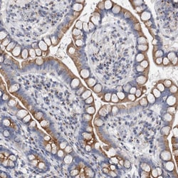 Invitrogen AKAP9 Polyclonal Antibody 100 &mu;L; Unconjugated:Antibodies,