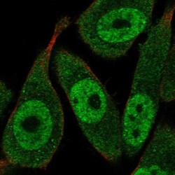 Invitrogen RAD23A Polyclonal Antibody 100 &mu;L; Unconjugated:Antibodies,