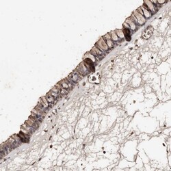 Invitrogen VLK Polyclonal Antibody 100 μL; Unconjugated:Antibodies,