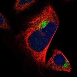 Invitrogen ALS2CR2 Polyclonal Antibody 100 &mu;L; Unconjugated:Antibodies,