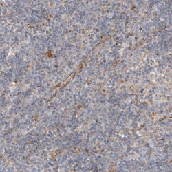 Invitrogen ALS2CR2 Polyclonal Antibody 100 &mu;L; Unconjugated:Antibodies,