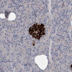 Invitrogen ALS2CR2 Polyclonal Antibody 100 &mu;L; Unconjugated:Antibodies,