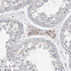 Invitrogen ALS2CR2 Polyclonal Antibody 100 &mu;L; Unconjugated:Antibodies,