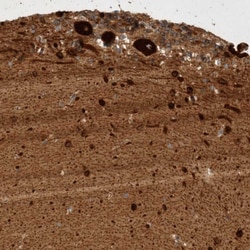 Invitrogen GPR150 Polyclonal Antibody 100 &mu;L; Unconjugated:Antibodies,