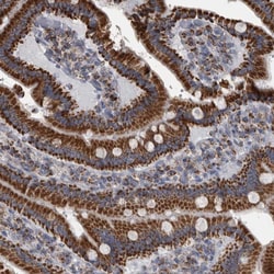 Invitrogen MDH2 Polyclonal Antibody 100 &mu;L; Unconjugated:Antibodies,
