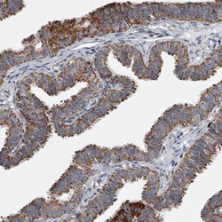 Invitrogen MDH2 Polyclonal Antibody 100 &mu;L; Unconjugated:Antibodies,
