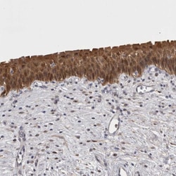 Invitrogen CHIC2 Polyclonal Antibody 100 &mu;L; Unconjugated:Antibodies,