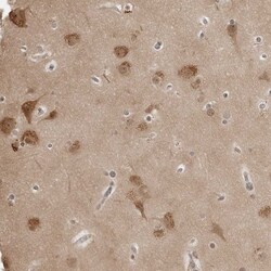 Invitrogen 14-3-3 gamma Polyclonal Antibody 100 &mu;L | Buy Online | Invitrogen&trade; | Fisher Scientific