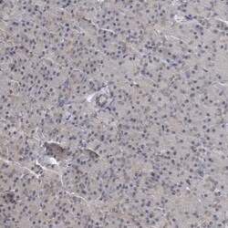 Invitrogen 14-3-3 gamma Polyclonal Antibody 100 &mu;L | Buy Online | Invitrogen&trade; | Fisher Scientific