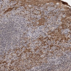 Invitrogen 14-3-3 gamma Polyclonal Antibody 100 &mu;L | Buy Online | Invitrogen&trade; | Fisher Scientific